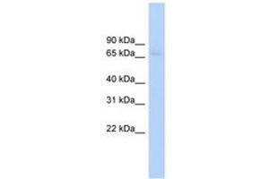 Image no. 1 for anti-ATP-Binding Cassette, Sub-Family F (GCN20), Member 2 (ABCF2) (AA 503-552) antibody (ABIN6744747)