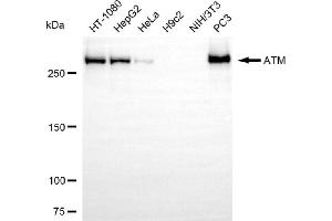 Western blotting analysis using ATM antibody (ABIN7797668). (Recombinant ATM anticorps)