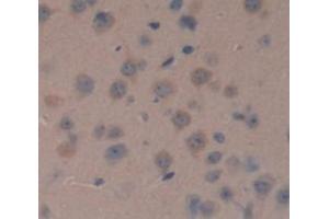 Figure. (NME1 anticorps  (AA 6-147))