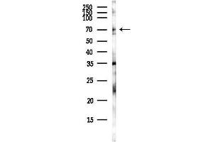 anti-Suppressor of Cytokine Signaling 5 (SOCS5) antibody
