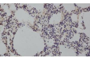 Immunohistochemistry of paraffin-embedded Rat lung using MMP8 Polyclonal Antibody at dilution of 1:50 (MMP8 anticorps)