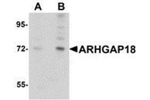 Western blot analysis of ARHGAP18 in 3T3 cell lysate with AP30079PU-N ARHGAP18 antibody at (A) 1 and (B) 2 μg/ml. (ARHGAP18 anticorps  (C-Term))