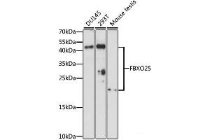 Western blot analysis of extracts of various cell lines using FBXO25 Polyclonal Antibody at dilution of 1:1000. (FBXO25 anticorps)