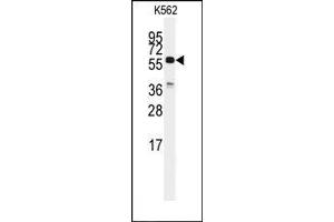 Image no. 1 for anti-Cell Division Cycle 25 Homolog C (S. Pombe) (CDC25C) (C-Term) antibody (ABIN360223) (CDC25C anticorps  (C-Term))