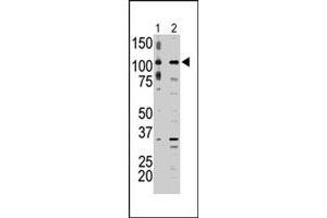 The MAP3K9 polyclonal antibody  is used in Western blot to detect MAP3K9 in A-375 cell lysate (lane 1) and rat testis tissue lysate (lane 2) . (MAP3K9 anticorps  (C-Term))