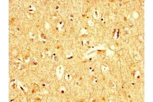 IHC image of ABIN7174409 diluted at 1:200 and staining in paraffin-embedded human brain tissue performed on a Leica BondTM system.