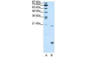 WB Suggested Anti-RUNX1  Antibody Titration: 0. (RUNX1 anticorps  (N-Term))