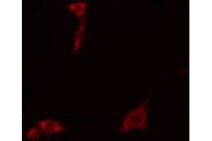 ABIN6272315 staining COLO205 cells by IF/ICC. (GS28 anticorps  (Internal Region))