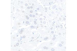 Immunohistochemistry (IHC) image for anti-Nucleoprotein TPR (TPR) (C-Term) antibody (ABIN7448922) (TPR anticorps  (C-Term))