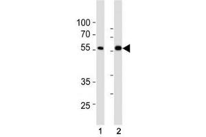 SMAD6 antibody western blot analysis in (1) HepG2 and (2) HT29 lysate. (SMAD6 anticorps  (AA 358-386))