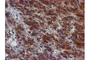 Image no. 1 for anti-Makorin Ring Finger Protein 1 (MKRN1) antibody (ABIN1499486)