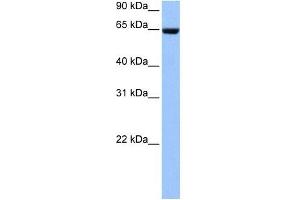 Collagen Type IV alpha 3 antibody used at 1 ug/ml to detect target protein. (COL4a3 anticorps)