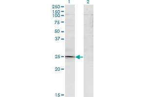 Western Blot analysis of TGIF2 expression in transfected 293T cell line by TGIF2 monoclonal antibody (M15), clone 2A4.