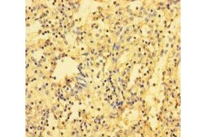 Immunohistochemistry of paraffin-embedded human spleen tissue using ABIN7171517 at dilution of 1:100 (ABI3BP anticorps  (AA 601-900))