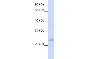 WB Suggested Anti-FAM156A Antibody Titration:  0. (FAM156A anticorps  (Middle Region))