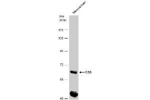WB Image CBS antibody detects CBS protein by western blot analysis.