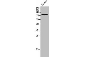 Western Blot analysis of JK cells using Phospho-DRP1 (S637) Polyclonal Antibody (Dynamin 1-Like anticorps  (pSer637))