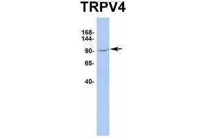 Host:  Rabbit  Target Name:  TRPV4  Sample Type:  HT1080  Antibody Dilution:  1. (TRPV4 anticorps  (Middle Region))