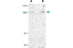 Western blot analysis of TRPC3 in mouse heart tissue lysate with TRPC3 polyclonal antibody  at (A) 1 and (B) 2 ug/mL . (TRPC3 anticorps  (N-Term))