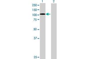 Western Blot analysis of ITGB2 expression in transfected 293T cell line by ITGB2 MaxPab polyclonal antibody. (Integrin beta 2 anticorps  (AA 1-769))