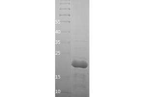 Western Blotting (WB) image for Lamin A/C (LMNA) (AA 26-198) protein (His tag) (ABIN7123712)