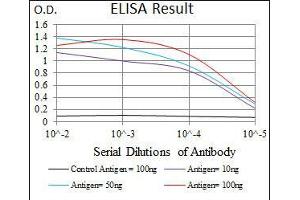 Black line: Control Antigen (100 ng), Purple line: Antigen(10 ng), Blue line: Antigen (50 ng), Red line: Antigen (100 ng), (TRIP6 anticorps  (AA 107-291))