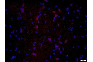 Paraformaldehyde-fixed, paraffin embedded tissue, Antigen retrieval by boiling in sodium citrate buffer(pH6) for 15min, Block endogenous peroxidase by 3% hydrogen peroxide for 30 minutes, Blocking buffer (normal goat serum) at 37°C for 20min, Antibody incubation with Rabbit Anti-CPLX1 Polyclonal Antibody, Unconjugated  at 1:400 overnight at 4°C, followed by a conjugated secondary and DAB staining