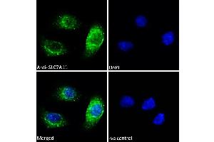 ABIN190899 Immunofluorescence analysis of paraformaldehyde fixed A549 cells, permeabilized with 0.