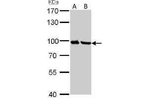 WB Image Plasminogen antibody detects PLG protein by Western blot analysis.