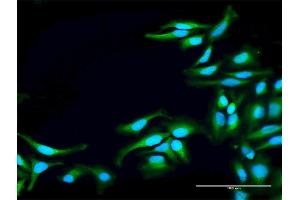 Immunofluorescence of purified MaxPab antibody to TNK2 on HeLa cell. (TNK2 anticorps  (AA 1-352))