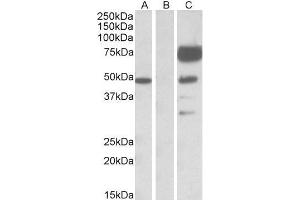 HEK293 lysate (10ug protein in RIPA buffer) overexpressing Human ANGPT1 with DYKDDDDK tag probed with ABIN768552(1ug/ml) in Lane A and probed with anti- DYKDDDDK Tag (1/1000) in lane C.