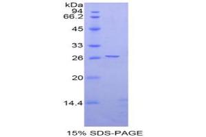 SDS-PAGE analysis of Rat Ephrin A4 Protein. (EFNA4 Protéine)
