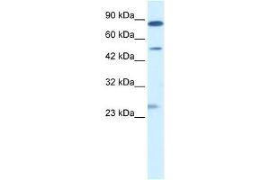 WB Suggested Anti-CLIC6 Antibody Titration:  0. (CLIC6 anticorps  (Middle Region))