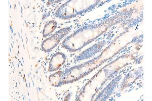 ABIN6267272 at 1/100 staining rat intestinal tissue sections by IHC-P.