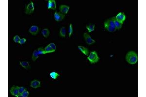 Immunofluorescent analysis of MCF-7 cells using ABIN7173179 at dilution of 1:100 and Alexa Fluor 488-congugated AffiniPure Goat Anti-Rabbit IgG(H+L) (TMEM255B anticorps  (AA 221-356))