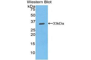 Western Blotting (WB) image for anti-Integrin beta 1 (ITGB1) (AA 454-714) antibody (ABIN1859501) (ITGB1 anticorps  (AA 454-714))