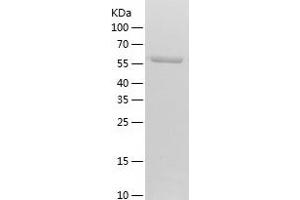 Western Blotting (WB) image for Pyruvate Kinase, Liver and RBC (PKLR) (AA 47-574) protein (His tag) (ABIN7124725)