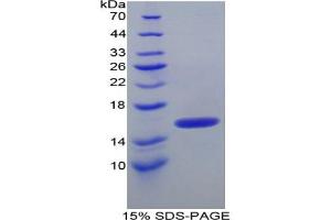 SDS-PAGE analysis of Human ITIH4 Protein. (ITIH4 Protéine)