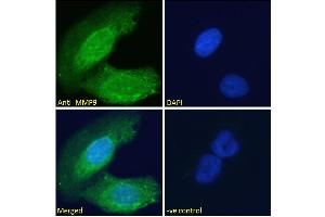 ABIN5539846 Immunofluorescence analysis of paraformaldehyde fixed U2OS cells, permeabilized with 0. (MMP 9 anticorps  (Internal Region))