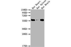 Western Blot Positive WB detected in: Rat Heart tissue, Rat Spleen tissue, Rat Brain tissue All lanes: PKM antibody at 1:4000 Secondary Goat polyclonal to Mouse IgG at 1/10000 dilution Predicted band size: 55-60 kDa Observed band size: 55-60 kDa (PKM anticorps  (AA 2-531))