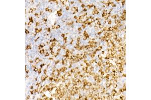 Immunohistochemistry of paraffin-embedded Human tonsil using CD74 antibody (ABIN7267759) at dilution of 1:100 (40x lens).
