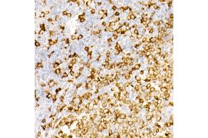 Immunohistochemistry of paraffin-embedded Human tonsil using CD74 antibody (ABIN7267759) at dilution of 1:100 (40x lens). (CD74 anticorps)
