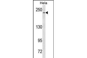 NOTCH3 Antibody  (ABIN1537680 and ABIN2843860) western blot analysis in Hela cell line lysates (35 μg/lane). (NOTCH3 anticorps  (C-Term))