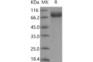 Western Blotting (WB) image for Mast/stem Cell Growth Factor Receptor (KIT) protein (His tag) (ABIN7321131)