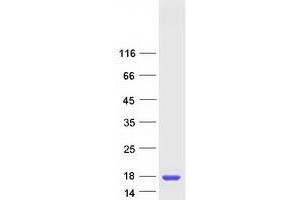 Validation with Western Blot
