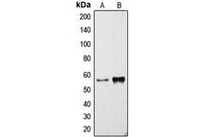 Western blot analysis of Cytochrome P450 3A4 expression in NCIH460 (A), human liver (B) whole cell lysates. (CYP3A4 anticorps  (Center))
