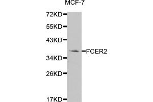 Western blot analysis of extracts of MCF-7 cells, using FCER2 antibody (ABIN5970939) at 1/1000 dilution. (FCER2 anticorps)