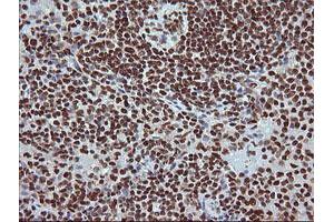 Image no. 7 for anti-Tripartite Motif Containing 38 (TRIM38) (AA 1-265) antibody (ABIN1490681) (TRIM38 anticorps  (AA 1-265))