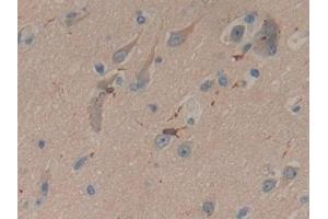 Detection of CORO1A in Human Brain Tissue using Polyclonal Antibody to Coronin 1A (CORO1A)