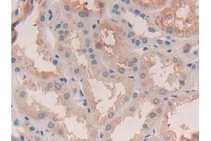 Detection of LGMN in Human Kidney Tissue using Polyclonal Antibody to Legumain (LGMN)